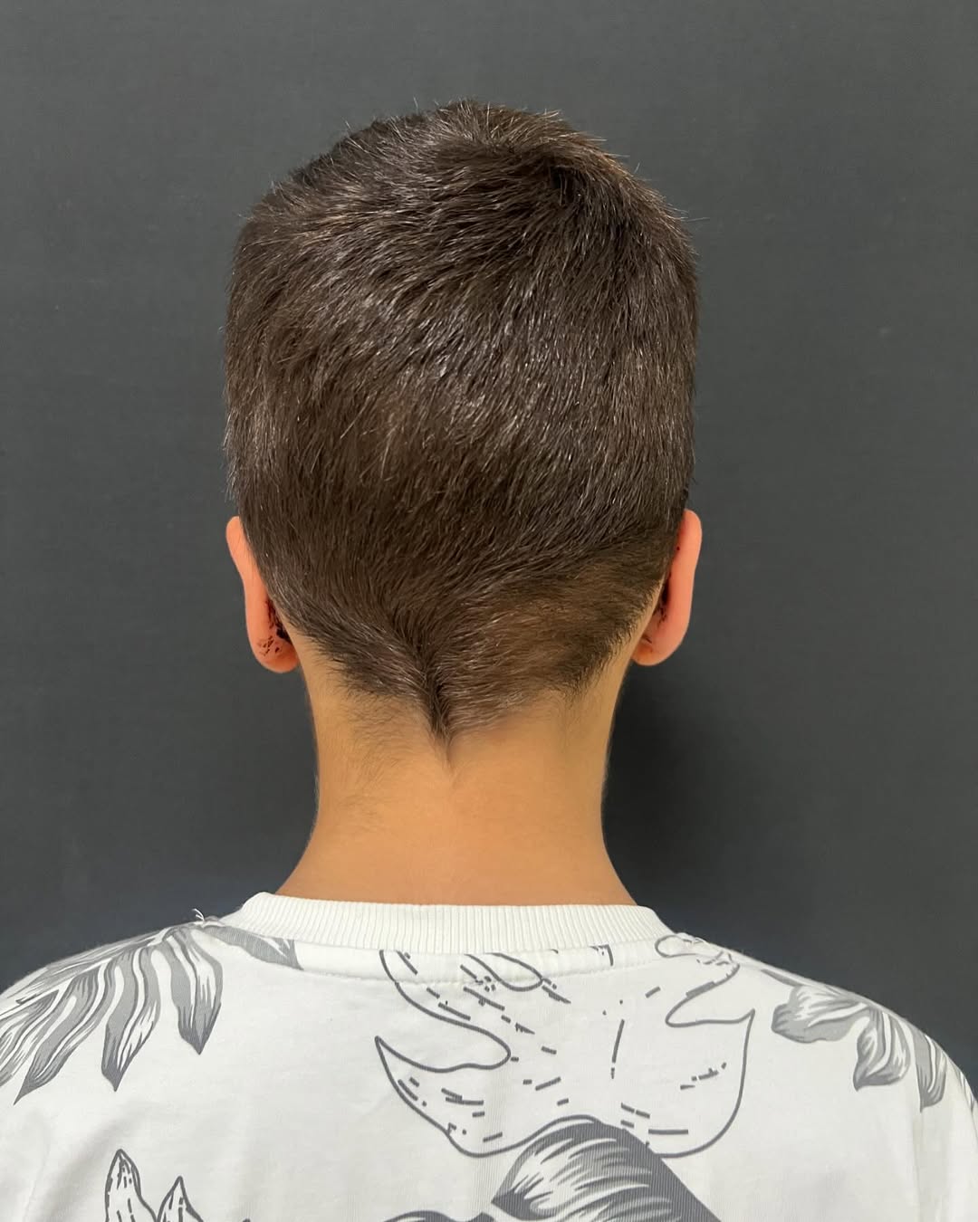 Отопластика